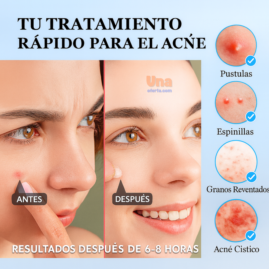 Parches Anti - Acné