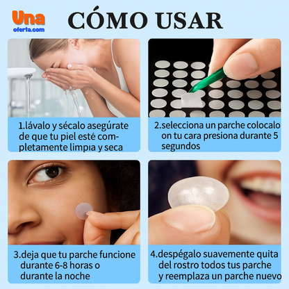 Parches Anti - Acné